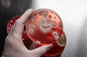 Mold investgation and sampling 